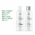 Dove Scalp + Hair Therapy Dandruff Control Shampoo, 400 ml