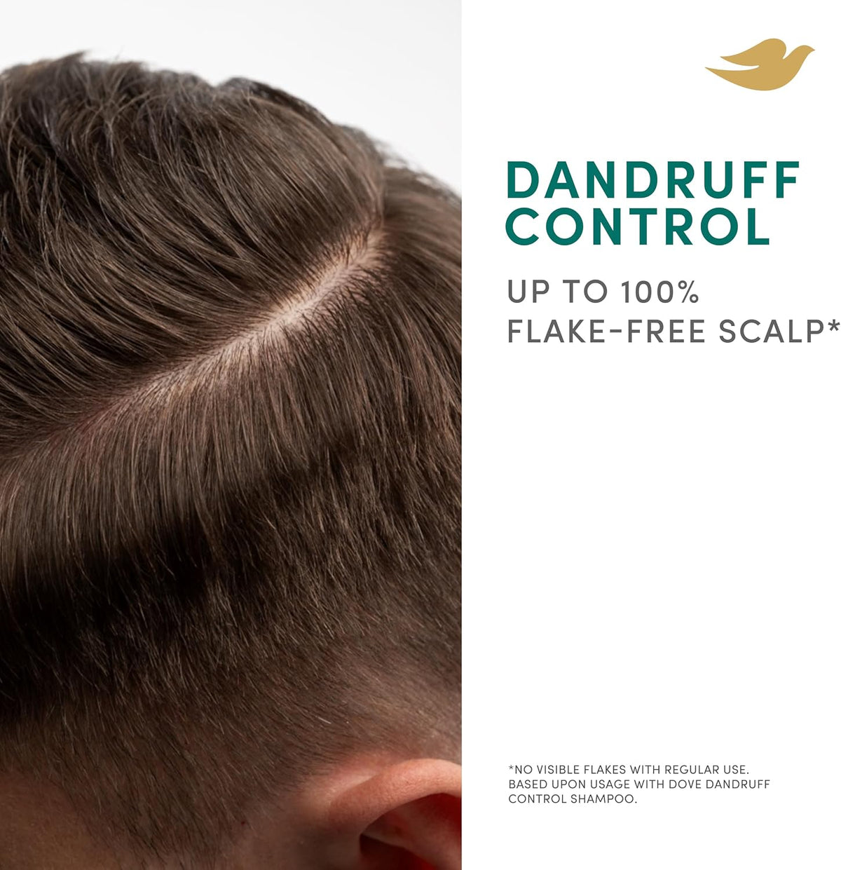 Dove Scalp + Hair Therapy Dandruff Control Shampoo, 400 ml