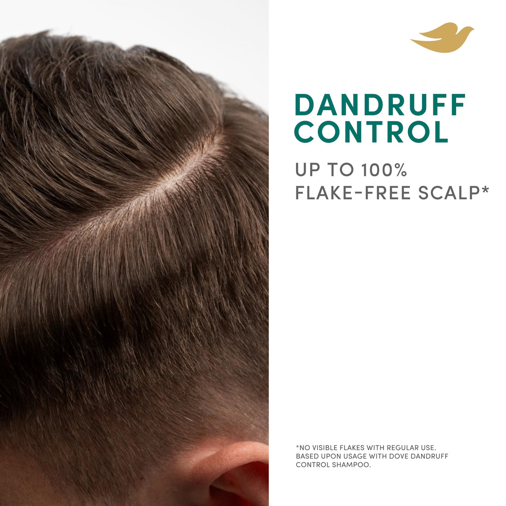 Dove Scalp + Hair Therapy Dandruff Control Shampoo, 400 ml